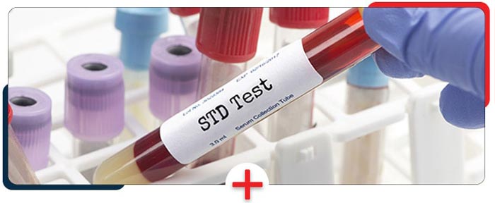 STD Testing and Treatment